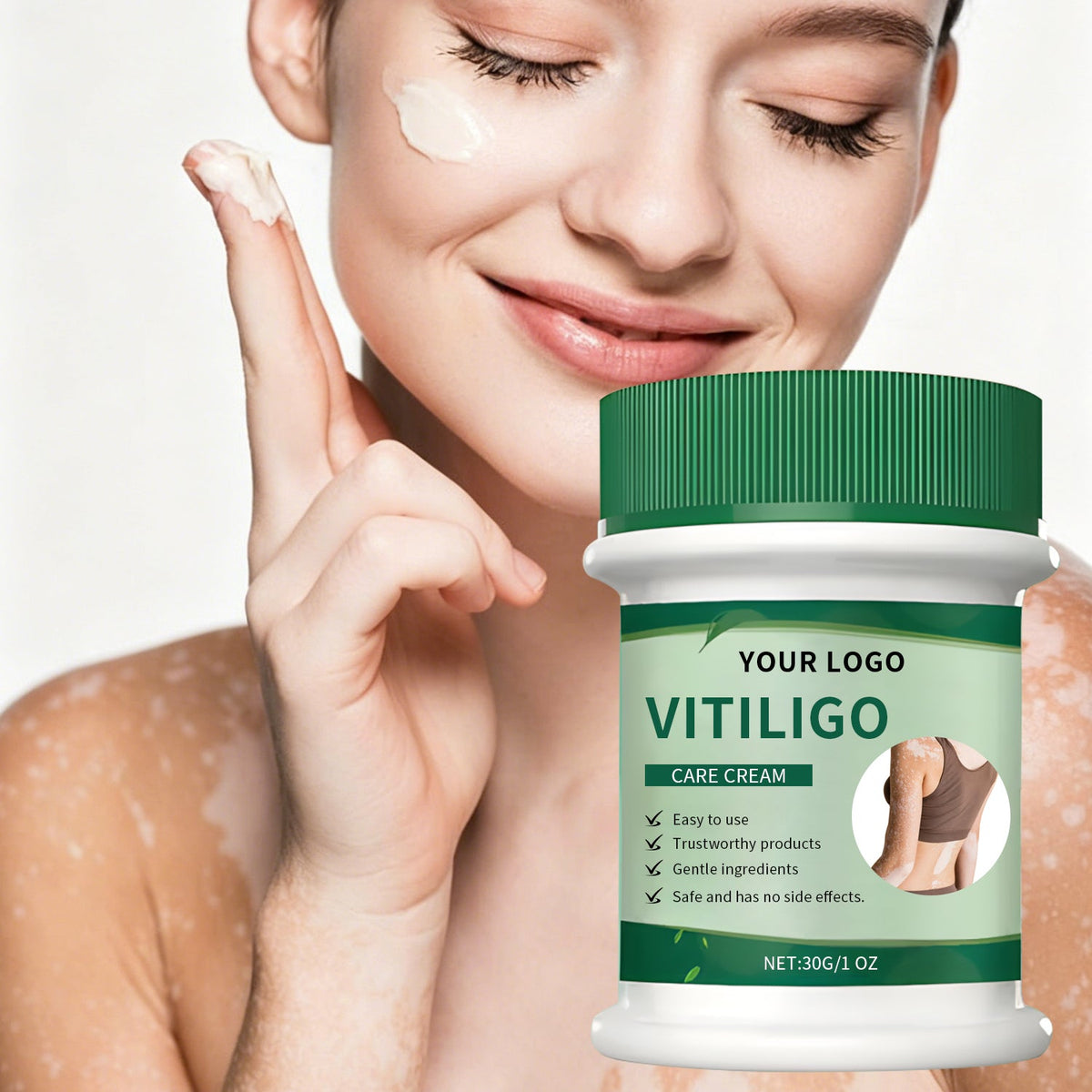 Vitiligo Herbal Cream