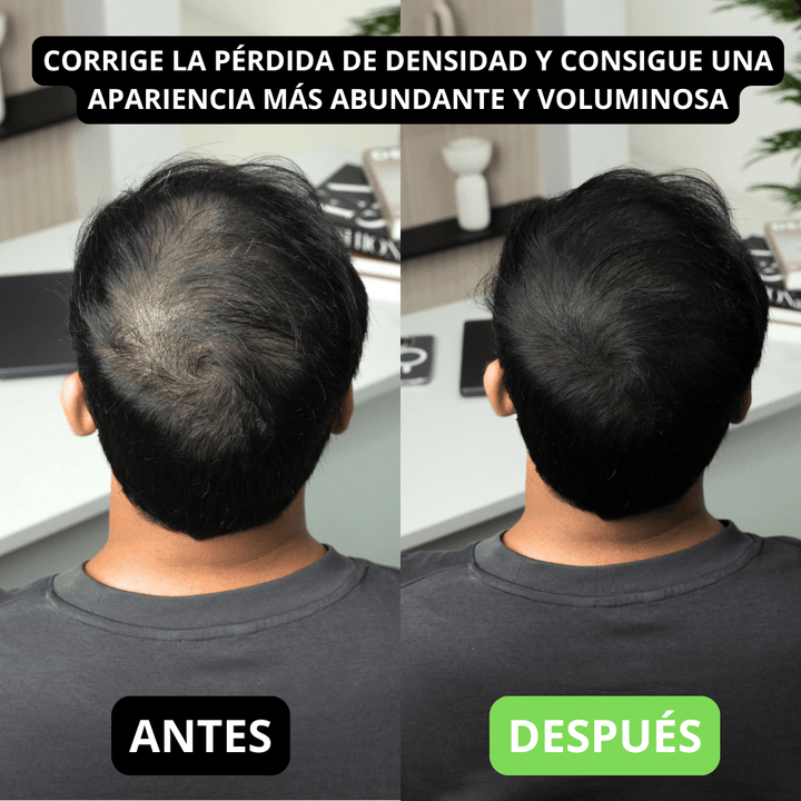 Hair Volume Powder for Men & women